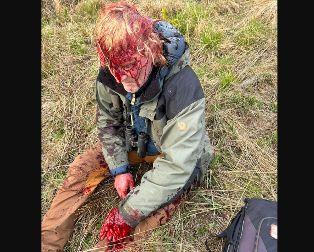 Deutschlands bekanntester Tierfilmer von Bär zerfleischt - er entkommt nur knapp dem Tod!